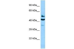 WB Suggested Anti-SH2D4A Antibody Titration: 1. (SH2D4A antibody  (N-Term))