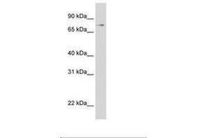Image no. 1 for anti-Signal Transducer and Activator of Transcription 1, 91kDa (STAT1) (AA 154-203) antibody (ABIN6736288) (STAT1 antibody  (AA 154-203))