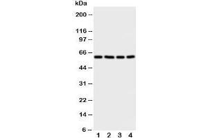 Western blot testing of RIP2 antibody and Lane 1:  A549;  2: HeLa;  3: PANC;  4: COLO320 cell lysate. (RIP2 antibody  (C-Term))