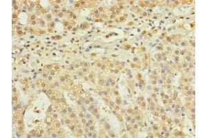 Immunohistochemistry of paraffin-embedded human adrenal gland tissue using ABIN7168124 at dilution of 1:100 (RPP25L antibody  (AA 1-163))