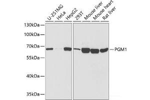 Western blot analysis of extracts of various cell lines using PGM1 Polyclonal Antibody at dilution of 1:1000. (Phosphoglucomutase 1 antibody)