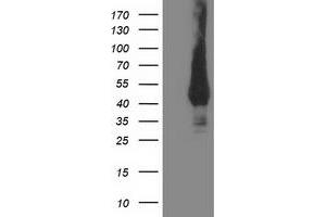 Western Blotting (WB) image for anti-Mevalonate Kinase (MVK) antibody (ABIN1499604) (MVK antibody)