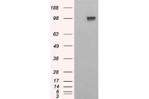 HEK293 overexpressing Human ENPP1 and probed with ABIN2562424 (mock transfection in first lane). (ENPP1 antibody  (C-Term))