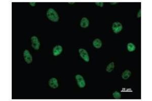 Immunostaining analysis in HeLa cells. (CDC5L antibody)
