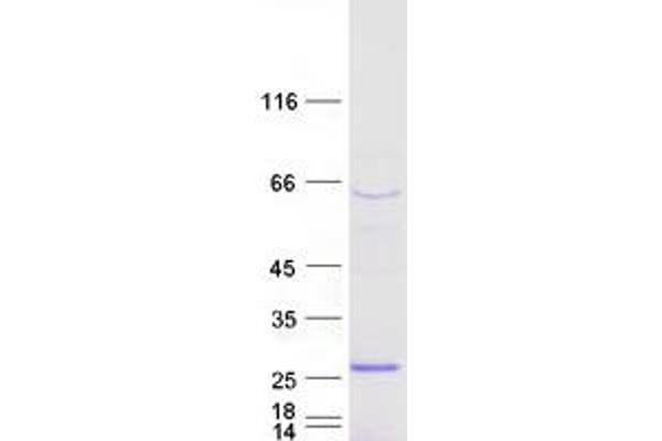 SSX3 Protein (Transcript Variant 2) (Myc-DYKDDDDK Tag)