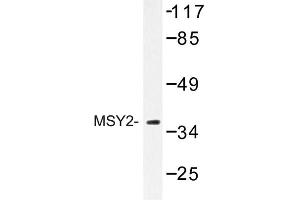 Image no. 1 for anti-Y Box Binding Protein 2 (YBX2) antibody (ABIN272262) (YBX2 antibody)