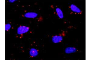 Proximity Ligation Analysis of protein-protein interactions between CAMK2A and SMAD2. (SMAD2 antibody  (AA 181-280))