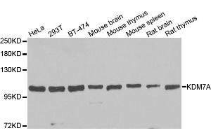 Western blot analysis of extracts of various cell lines, using KDM7A antibody. (JHDM1D antibody)