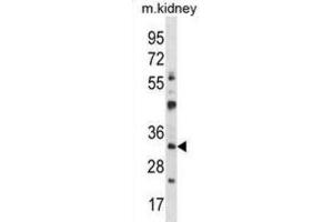 Western Blotting (WB) image for anti-General Transcription Factor IIB (GTF2B) antibody (ABIN2997924) (GTF2B antibody)