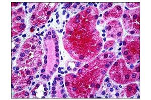 Human Kidney: Formalin-Fixed, Paraffin-Embedded (FFPE) (KCNN4 antibody  (AA 227-239))