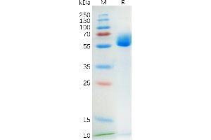 Human SCF Protein, hFc Tag on SDS-PAGE under reducing condition. (KIT Ligand Protein (KITLG) (AA 26-214) (Fc Tag))