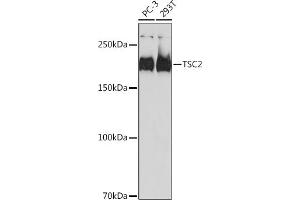 Western blot analysis of extracts of various cell lines, using TSC2 antibody (ABIN7271027) at 1:1000 dilution. (Tuberin antibody)