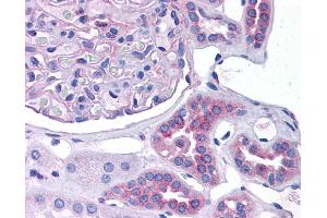 CCL2 antibody was used for immunohistochemistry at a concentration of 4-8 ug/ml. (CCL2 antibody  (Middle Region))