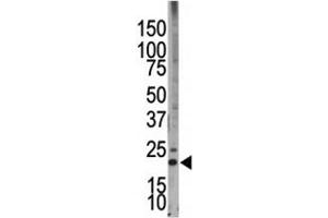 Western blot testing of Bim antibody and HL-60 cell lysate (BIM antibody  (AA 130-165))