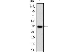 Fig. (PRKACA antibody  (AA 1-120))