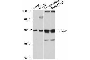 Western blot analysis of extracts of various cell lines, using SLC2A1 antibody (ABIN5998856) at 1/1000 dilution. (GLUT1 antibody)