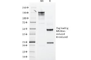 SDS-PAGE Analysis Purified CD61 Mouse Monoclonal Antibody (ITGB3/2145). (Integrin beta 3 antibody  (AA 385-490))