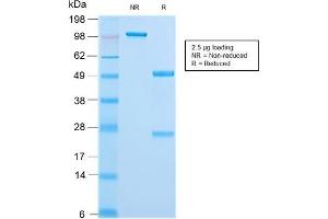 SDS-PAGE (SDS) image for anti-Keratin 18 (KRT18) antibody (ABIN6939938)