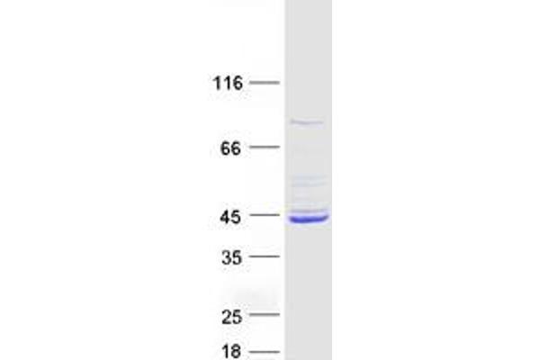 MCAT Protein (Transcript Variant 1) (Myc-DYKDDDDK Tag)