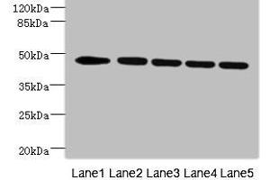 Western blot All lanes: DCXR antibody at 4. (VRK1 antibody  (AA 257-396))