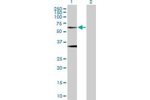 Western Blot analysis of GLRA1 expression in transfected 293T cell line by GLRA1 MaxPab polyclonal antibody. (GLRA1 antibody  (AA 1-449))