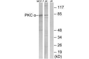 Western blot analysis of extracts from MCF-7 cells and Jurkat cells, using PKC α (Ab-657) antibody. (PKC alpha antibody  (Tyr657))