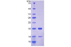 SDS-PAGE analysis of Chicken FABP4 Protein. (FABP4 Protein)