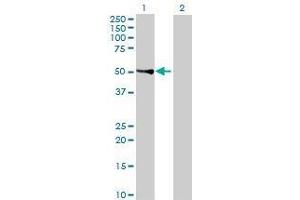 Lane 1: CYP4F22 transfected lysate ( 62 KDa) Lane 2: Non-transfected lysate. (FLJ39501 293T Cell Transient Overexpression Lysate(Denatured))