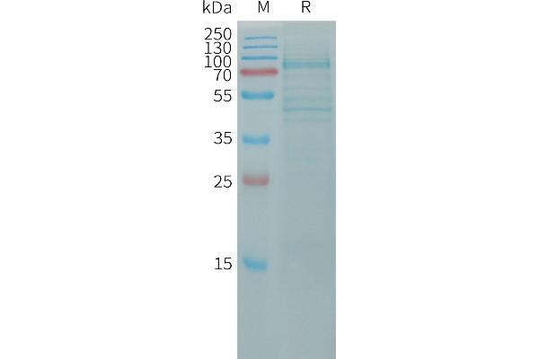 OB Cadherin Protein (AA 23-617) (His tag)