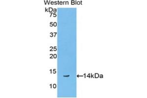 Western blot analysis of the recombinant protein. (Biglycan antibody  (AA 48-158))