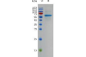 SARS-CoV-2 (Omicron BA. (SARS-CoV-2 Spike Protein (BA.2 - Omicron, RBD) (Fc Tag))