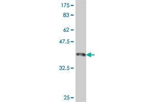 Western Blot detection against Immunogen (37. (SMC1A antibody  (AA 366-465))