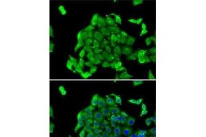 Immunofluorescence analysis of MCF7 cells using RPS14 Polyclonal Antibody (RPS14 antibody)