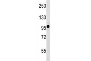 Integrin beta 7 antibody western blot analysis in WiDr lysate. (Integrin beta 7 antibody  (AA 737-765))