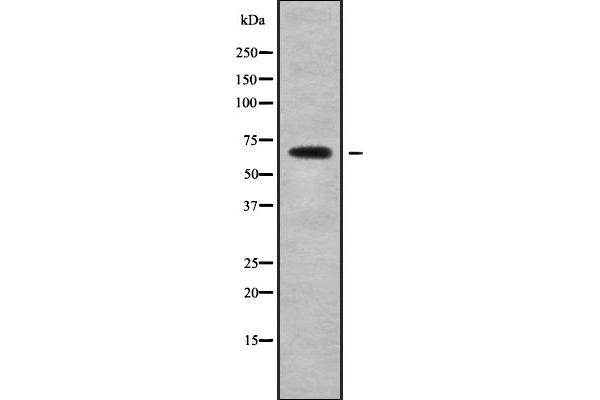 MAGED2 antibody  (N-Term)