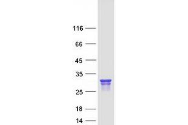 THEM4 Protein (Myc-DYKDDDDK Tag)