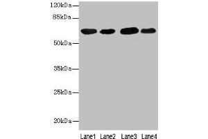 Western blot All lanes: ESR1 antibody at 7 μg/mL Lane 1: Hela whole cell lysate Lane 2: MCF-7 whole cell lysate Lane 3: Rat brain tissue Lane 4: Colo320 whole cell lysate Secondary Goat polyclonal to rabbit IgG at 1/10000 dilution Predicted band size: 67, 54, 48, 36 kDa Observed band size: 67 kDa (Estrogen Receptor alpha antibody  (AA 10-591))