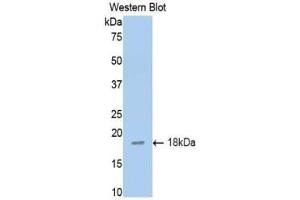 Western blot analysis of the recombinant protein. (TNFRSF10B antibody  (AA 54-180))