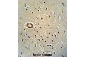 Immunohistochemistry (IHC) image for anti-CWC22 Spliceosome-Associated Protein Homolog (CWC22) antibody (ABIN2995841) (CWC22 antibody)