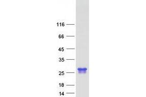 Validation with Western Blot (GGCT Protein (Myc-DYKDDDDK Tag))