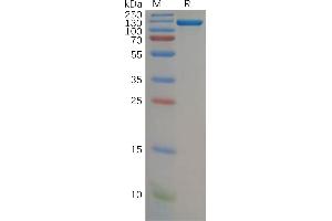 Human CFB Protein, hFc Tag on SDS-PAGE under reducing condition. (Complement Factor B Protein (CFB) (AA 26-764) (Fc Tag))