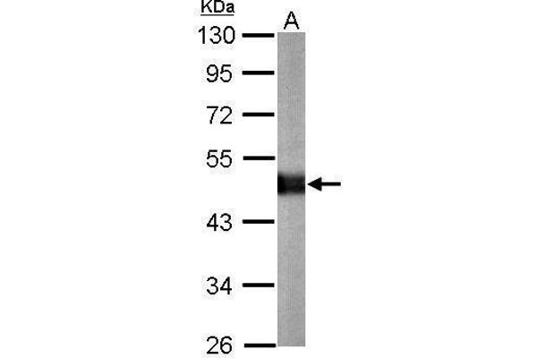 CPE antibody