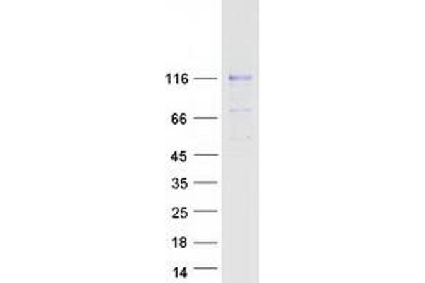 MATN2 Protein (Transcript Variant 1) (Myc-DYKDDDDK Tag)