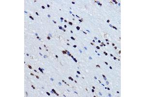 Immunohistochemistry of paraffin-embedded mouse brain using TDP-43/TARDB Rabbit pAb  at dilution of 1:500 (40x lens). (TARDBP antibody  (AA 1-100))