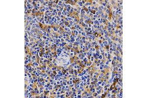 Immunohistochemistry of paraffin-embedded rat spleen using CDK20 antibody (ABIN5971446) at dilution of 1/200 (40x lens). (CCRK antibody)