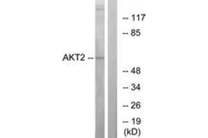 Western Blotting (WB) image for anti-V-Akt Murine Thymoma Viral Oncogene Homolog 2 (AKT2) (AA 432-481) antibody (ABIN2888944) (AKT2 antibody  (AA 432-481))