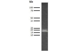 Western Blotting (WB) image for anti-Adiponectin (ADIPOQ) antibody (ABIN613395) (ADIPOQ antibody)