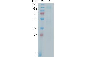 Mouse IGF-1R Protein, His Tag on SDS-PAGE under reducing condition. (IGF1R Protein (AA 31-936) (His tag))