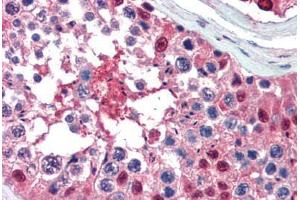 Human Testis (formalin-fixed, paraffin-embedded) stained with Ubiquitin antibody ABIN462097 at 10 ug/ml followed by biotinylated goat anti-rabbit IgG secondary antibody ABIN481713, alkaline phosphatase-streptavidin and chromogen. (Ubiquitin antibody)