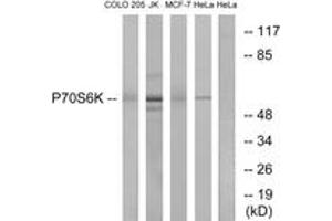 Western Blotting (WB) image for anti-Ribosomal Protein S6 Kinase, 70kDa, Polypeptide 1 (RPS6KB1) (AA 384-433) antibody (ABIN2888684) (RPS6KB1 antibody  (AA 384-433))